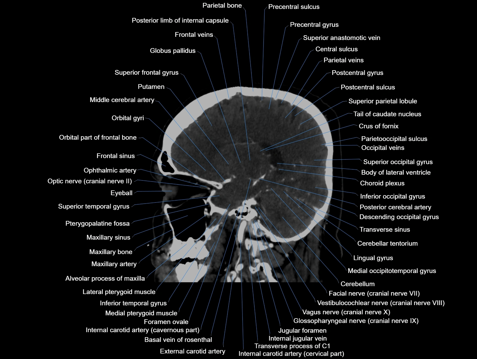 CT scan brain sagittal cross sectional anatomy image-img-00001-00029.webp